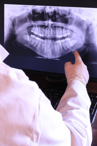 Best Emergency Dental Care for Broken or Chipped Teeth in Lake Erie Beach, NY